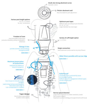 AnyRidge® Implant – Stability Without Limits